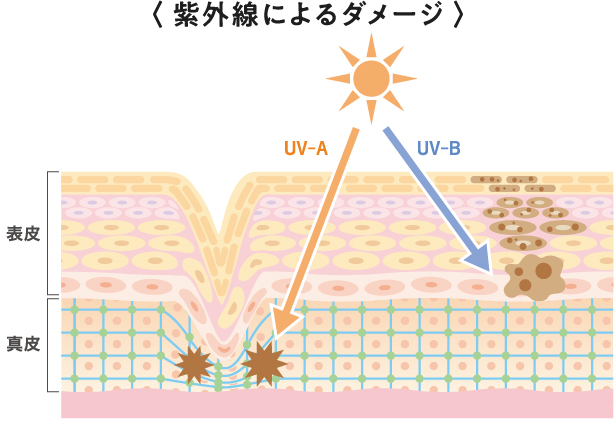 紫外線によるダメージ