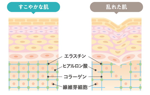 コラーゲンが減った肌イメージ